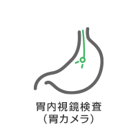 胃内視鏡検査（胃カメラ）
