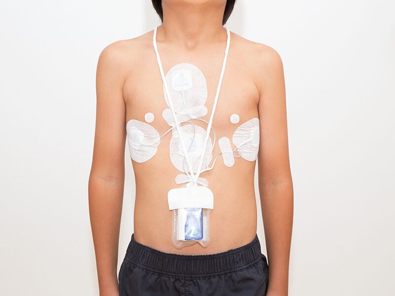 ホルター心電図