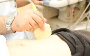 腹部超音波検査（エコー）